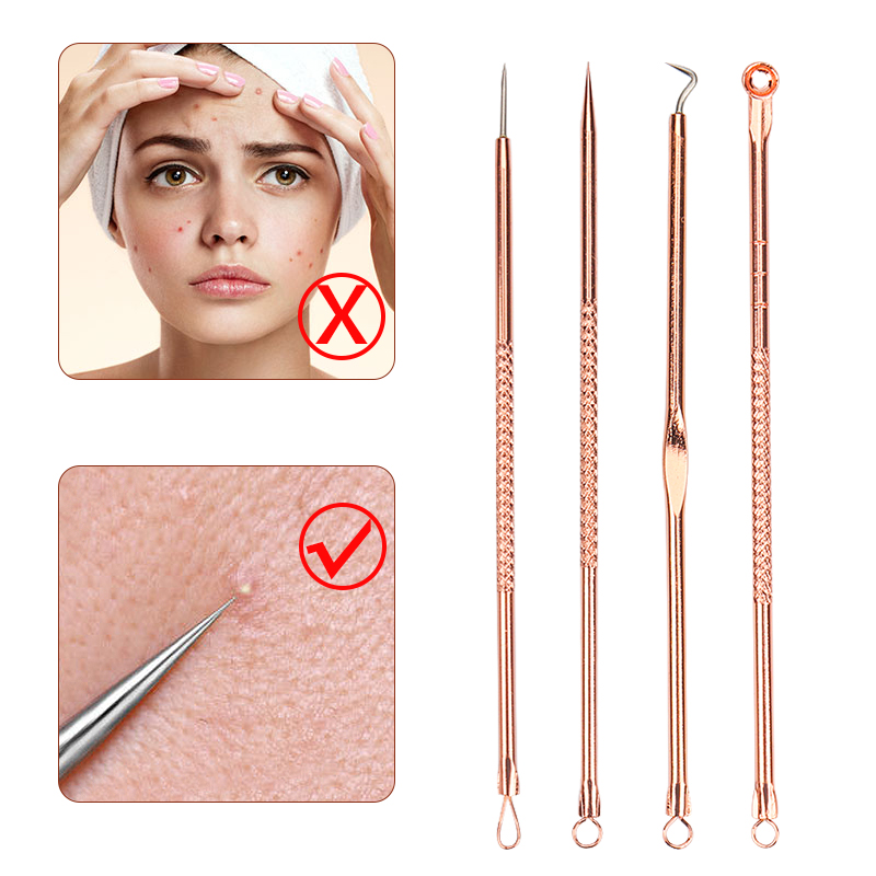 Conjunto de 4 Peças de Agulhas - Skincare Ingredients Checker avaliação e preço